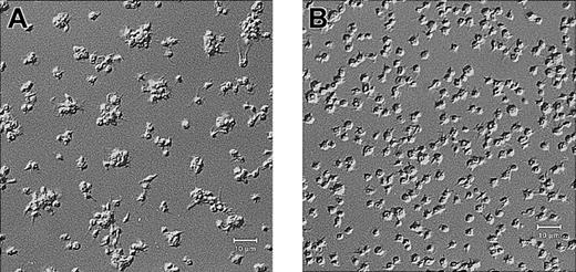 Fig. 2. Platelets from a patient with Glanzmann thrombasthenia have decreased platelet spreading and platelet-platelet interactions on collagen. / Control platelets (A) and platelets from a patient with Glanzmann thrombasthenia (B) were anticoagulated with ACD, washed twice, and resuspended in HBMT buffer (100 000/μL). Platelets were added to channels in the collagen-coated microchamber, incubated for 60 minutes at 22°C, and analyzed by differential interference microscopy. Control platelets demonstrate platelet-platelet interactions and platelet spreading. The patient's platelets demonstrate few platelet-platelet interactions, a relatively uniformly scattered pattern of platelet deposition, and less platelet spreading. Scale bars represent 10 μm.
