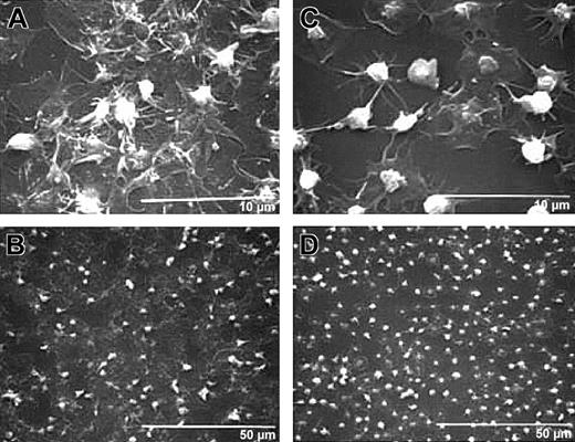 Fig. 3. Treatment with antibody 7E3 decreases platelet spreading and development of a sheetlike mass. / Human platelets were anticoagulated with ACD, gel-filtered, and untreated or treated with 7E3 (10 μg/mL) for 15 minutes at 22°C. Platelets (120 000 μL; 50 μL) were added to the collagen-coated microtiter wells and incubated for 1 hour, and then the specimens were prepared for scanning electron microscopy. High-power (A) and low-power (B) views of untreated human platelets show extensive platelet spreading and additional layers of platelets on top of the spread platelets. High-power (C) and low-power (D) views show that 7E3-treated platelets extend filopodia and spread variably but do not form a sheetlike surface; they also retain their granulomeres to a greater extent than do the platelets making up the initial layer of untreated platelets.