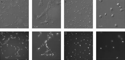 Fig. 4. P-selectin staining of 7E3-treated platelets adherent to collagen is confined to the granulomere, whereas staining of control murine antibody–treated platelets is distributed throughout the sheetlike mass of platelets. / Differential interference contrast microscopy images of normal human platelets in the presence of control murine antibody (A) or 7E3 (B) deposited on collagen for 1 hour at 22°C. Panels on the left are at lower magnification and panels on the right are at higher magnification. Panels C and D contain P-selectin immunofluorescence images of panel A and panel B, respectively. P-selectin staining of the control antibody–treated platelets is distributed throughout the sheetlike mass, including punctate staining near the edges of the spread platelets, whereas the staining of the 7E3-treated platelets was more distinct and better localized to the granulomere areas.