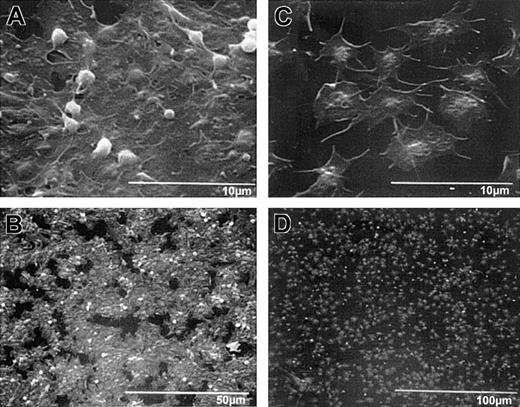 Fig. 6. Scanning electron micrographs of wild-type and β3-null mouse platelets adherent to collagen demonstrate platelet morphologic features similar to those of human platelets without and with treatment with 7E3, respectively. / Wild-type and β3-null mouse blood was collected into ACD, and the resultant PRP/PRB mixtures were added to collagen-coated microtiter wells for 1 hour. Samples were then prepared for scanning electron microscopy. High-power (A) and low-power (B) views of wild-type platelets, and high-power (C) and low-power (D) views of β3-null platelet adhesion. Wild-type platelets in panel A show that the platelets have spread in a sheetlike formation; a few remaining follower platelets, with their granulomeres intact, are seen on top of the spread platelets. The extensive “island” formation is apparent at lower power (B). (C) The β3-null platelets do not spread as a sheet, though they appear to spread individually more than human platelets in the presence of 7E3. Note also Figure 3C.