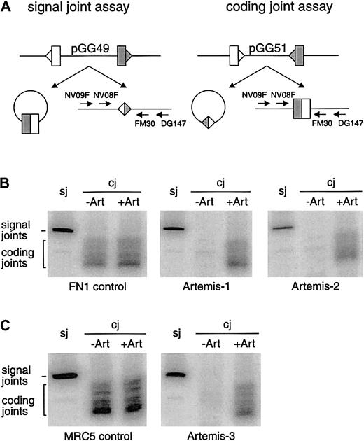 Fig. 3. V(D)J recombination assay in RS-SCID fibroblasts withArtemis gene mutations. / (A) Schematic representation of the signal joint assay (sj) and the coding joint assay (cj) in which the recombination substrates pGG49 and pGG51 were used, respectively. Recombination signal sequences are depicted as triangles and the flanking coding sequence as rectangles. The signal joints are retained in the recombination substrate when pGG49 is used, while coding joints are retained in the recombination substrate when pGG51 is used. Signal joints and coding joints were detected with nested PCR analysis using a 32P-labeled primer (see “Materials and methods”). (B) Primary fibroblasts of Artemis-1 and Artemis-2 transfected with RAG1 andRAG2 expression constructs and the recombination substrate formed signal joints but no coding joints. FN1 control primary fibroblasts can form both signal joints and coding joints. Defective coding joint formation in Artemis-1 and Artemis-2 could be complemented by cotransfection of the wt Artemis expression construct (+Art). (C) SV40-immortalized fibroblasts of Artemis-3 were also able to form signal joints but not coding joints. Like in Artemis-1 and Artemis-2, coding joint formation occurred upon cotransfection of the wt Artemis expression construct. SV40-immortalized MCR5 fibroblasts were used as control.