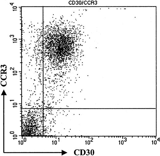 Fig. 2. Coexpression of CD30 and CCR3. / Flow cytometric analysis of tumor cell population. Staining of freshly isolated tumor cells shows coexpression of CD30 and CCR3. Please note high expression of CCR3 on tumor cells (patient no. 7). Data shown are representative of 3 experiments.