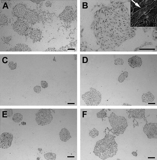Fig. 3. Effect of VEGF-C on ECs. / (A-B) Cultures stimulated by 100 ng/mL VEGF-C. In contrast to VEGF-A, VEGF-C did not induce EC dispersion. (B, inset) Larger magnification (× 2000) shows that VEGF-C–treated ECs become spindlelike (arrow), although EC clusters are maintained. (C) In this culture, addition of mFlt-1-hIgG reduced the size of EC colonies. Addition of exogenous VEGF-C overcomes this suppression in a dose-dependent manner. Concentrations of VEGF-C were 10 ng/mL (panel D), 30 ng/mL (panel E), and 100 ng/mL (panel F). While the size of EC clusters increased, colonies are packed. Scale bar, 200 μm.