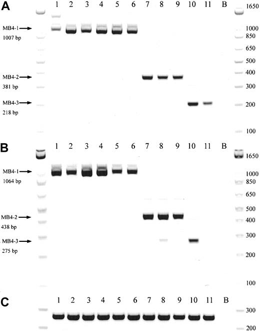 Fig. 2. Representative gel from 11 t(4;14)+patients. / (A) Representative gel of 11 t(4;14)+ patients, with various breakpoints, detected by a JH-ms6r assay. Lane B, negative control. (B) Representative gel of the same 11 patients detected by an Ιμ1-ms6r assay; lane B, negative control. (C) cDNA integrity tests with β2-M primers on the 11 patient samples; lane B, negative control.