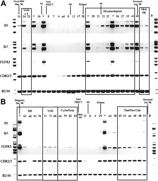 Fig. 5. Longitudinal analysis of IgH-MMSET hybrid transcripts and FGFR3. / PB and BM samples collected over the course of disease from 2 t(4;14)+ FGFR3-expressing MM patients are shown. The monoclonal protein values (g/L) at each visit are marked above each PB sample, and BM samples are denoted by an asterisk. Clinical diagnosis and relapse along with therapy are noted. Auto-PBSCT indicates autologous peripheral blood stem cell transplantation following high-dose therapy; Mob PB, apheresis product from mobilized peripheral blood. Representative panels for each reaction are shown. JH, JH-ms6r hybrid transcript assay; Iμ1, Iμ1-ms6r hybrid transcript assay; FGFR3, FGFR3 expression; CDR2/3, CDR2-CDR3 patient-specific transcript assay; B2-M, positive control for integrity of RNA. (A) The patient whose results are shown has the MB4-3 breakpoint type; however, the breakpoint occurs between exon 4 and exon 4a, creating a doublet band. The upper band of the doublet results from alternative splicing to exon 4a, as in Figure 1A. (B) The patient whose results are shown has the MB4-1 breakpoint type.