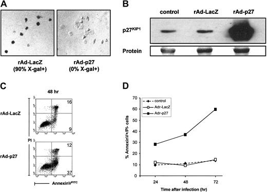 Fig. 5. Overexpression of p27KIP1 induces apoptosis in DCs. / (A) Evaluation transduction efficiency of rAd-LacZ or rAd-p27–infected immature DCs using X-gal. (B) DCs were infected with rAd-LacZ or rAd-p27. After 48 hours of culture in the presence of IL-4 and GM-CSF, infected DCs and control DCs were harvested for the preparation of whole cell lysates. Then equal amounts of protein (20 μg/lane) were loaded, and the levels of p27KIP1 were determined. Data shown are representative for 3 independent experiments with different donors. (C) DCs were infected with rAd-LacZ or rAd-p27 and subsequently cultured in IL-4 and GM-CSF. After 48 hours of culture, annexin V–FITC/PI staining was performed to determine the percentage of apoptotic cells. Data shown are representative for 2 independent experiments with different donors. (D) DCs were left untreated or infected with rAd-LacZ or rAd-p27 and subsequently cultured in IL-4 and GM-CSF. Cells were harvested after 24, 48, and 72 hours of culture. Annexin V–FITC/PI stainings were performed to determine the percentage of annexin V+/PI− (early apoptotic) cells (n = 2).