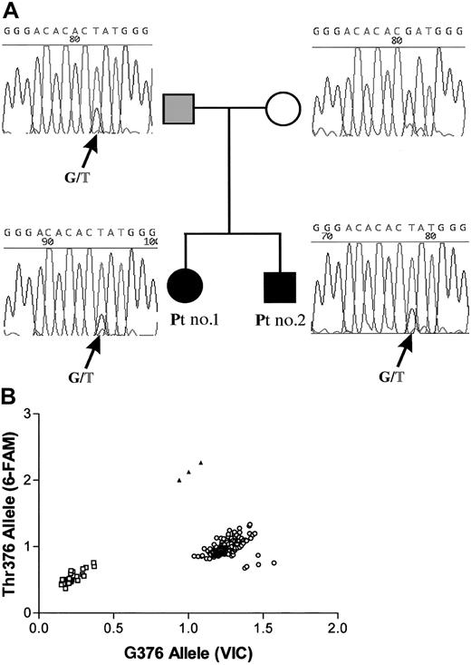 Fig. 2. Mutation of one VHL allele. / (A) Sequencing of the second exon of the VHL gene of patients 1 and 2 and their parents. The 376G>T (Asp126Tyr)VHL mutation found in patients 1 and 2 was inherited from the father. The father was not polycythemic, but his BFU-Es were hypersensitive to Epo. (B) 376T mutation analysis by a PCR-based discrimination assay with allele-specific fluorescent probes. PCR of the normal G376 allele leads to the release of the VIC fluorescent label, whereas the mutated T376 allele leads to the release of the 6-FAM fluorescent label. Controls (○); patients 1 and 2 and their father (▴); PCR without a DNA template (■). Our results confirm the heterozygosity for the G376Thr mutation in patients 1 and 2 and their father, and indicate that none of the 177 healthy controls have the mutated T376 allele.