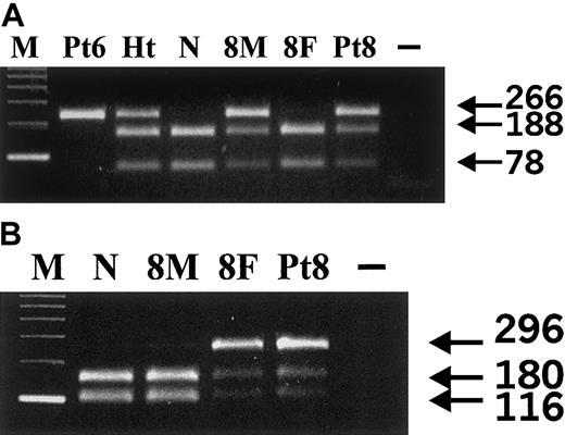 Fig. 3. Detection of 598C>T and 388G>C VHLmutations. / (A) 598C>T mutation analysis. Fnu4HI digests 266-bp PCR product of the wild-type VHL allele into 188- and 78-bp bands; the 598C>T mutation abolishes the restriction site resulting in the uncut 266-bp band. M indicates 123-bp DNA ladder; Pt6, patient 6; Ht: a heterozygote for the 598C>T mutation; N, healthy control; 8M, mother of patient 8; 8F, father of patient 8; Pt8, patient 8; −, no template. Our results indicate that patient 6 is homozygous and patient 8 and his mother are heterozygous for the 598C>T mutation. (B) 388G>C mutation analysis. HpaI digests PCR product of the 296-bp wild-type VHL allele into 180- and 116-bp bands; the 388G>C mutation abolishes the restriction site resulting in the uncut 296-bp band. M indicates 123-bp DNA ladder; N, healthy control; 8M, mother of patient 8; 8F, father of patient 8; Pt8, patient 8; −, no template. Our results indicate that patient 8 and his father are heterozygous for the 388G>C mutation.