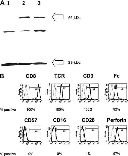Fig. 2. Genetically modified lymphocytes express the introduced CD19-specific chimeric immunoreceptor and are differentiated effector T cells. / (A) Western blot result from reduced whole T-cell lysates probed with an anti–CD3-ζ mAb. The unmodified T-cell line (lane 1) and representative genetically modified T-cell clones (lanes 2 and 3) each display a 21-kDa band consistent with the wild-type ζ chain. In addition, the 2 hygromycin-resistant T-cell clones demonstrate a second band of approximately 66 kDa consistent with the introduced chimeric ζ chain. (B) Phenotype of a CD19-specific T-cell clone using flow cytometry. Binding of specific mAbs (bold lines) is relative to isotype control (dotted lines), and the percentage of cells in the M2 gate is indicated.