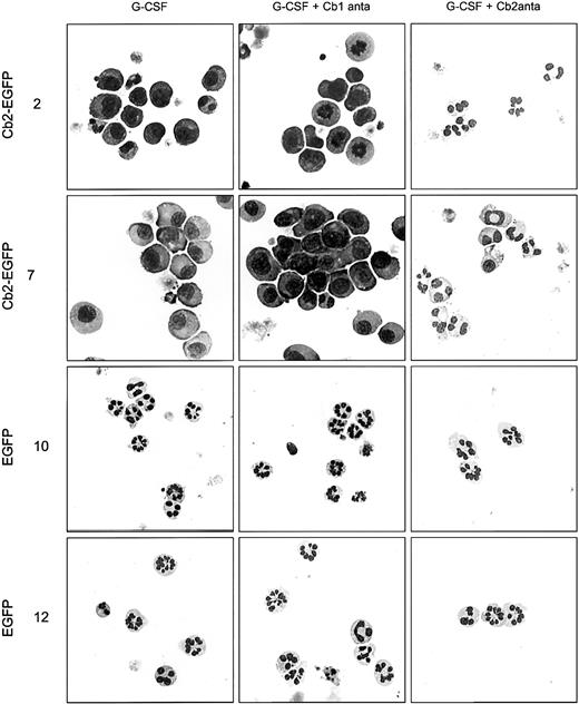 Fig. 5. Cell morphology of 32D/G-CSF-R cells cultured in different conditions. / Morphologic analysis of 2 Cb2-EGFP–expressing clones and 2 EGFP control clones cultured for 9 days in the presence of G-CSF, G-CSF plus Cb1-specific antagonist, or G-CSF plus Cb2-specific antagonist. Original magnifications × 63.