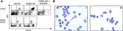 Fig. 8. Intraperitoneal neutrophil recruitment by CD95L-DCs. / (A) Bm12 or lpr/lpr bm12 mice were injected intraperitoneally with either 8 × 105 control or CD95L-DCs. PECs were analyzed 16 hours later by flow cytometry. 200 μg of RB6-8C5 (anti-Gr1) mAbs were inoculated 4 hours before CD95L-DC treatment. (B) PEC cytospin preparation from CD95L-DC– (panel i) or control DC– (panel ii) injected mice were stained with May-Grünwald-Giemsa solution to identify polymorphonuclear leukocytes (arrow). Original magnification, × 400. Experiments were repeated at least 5 times with similar results.