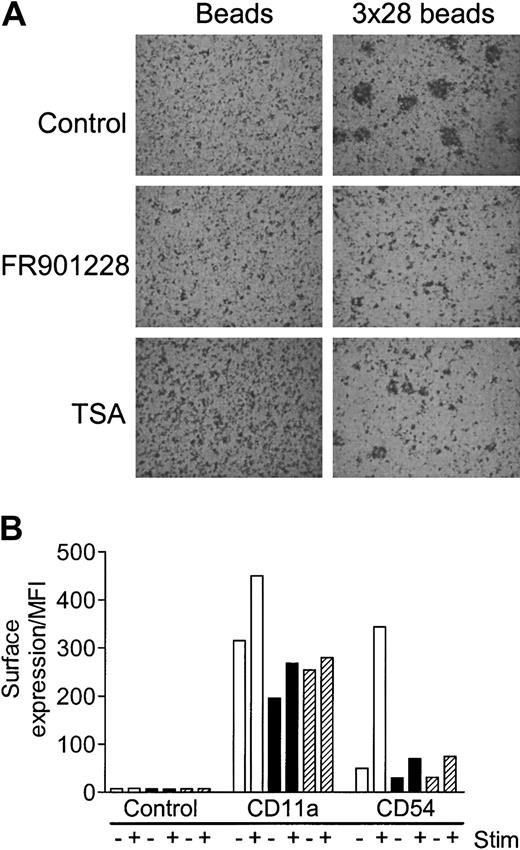 Fig. 5. HDAC-i influence on aggregation and expression of adhesion molecules after T-cell activation. / PBL cultures were preincubated with or without 20 ng/mL FR901228 or 100 ng/mL trichostatin A and stimulated for 24 hours with 3 × 28 beads or uncoupled beads. (A) A characteristic example of the HDAC-I–mediated inhibition of aggregation; similar results were always observed upon visual inspection of stimulated cells treated with HDAC-i. Original magnification, × 20. (B) CD11a and CD54 were measured by flow cytometry 24 hours after stimulation with control (−) or 3 × 28 beads (+) without (white bars) or with (black bars) 20 ng/mL FR901228 or 100 ng/mL trichostatin A (hatched bars). Results are shown as MFI of gated CD4 T cells.