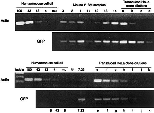 Fig. 1. Semiquantitative PCR analysis of NOD/SCID bone marrow cells reveals multiple vector copies per transduced cell. / Figure shows agarose gel used to quantify the amount of human DNA (human β-actin) and vector copy number (GFP) per total bone marrow sample. The standard curve for amount of human genomic DNA per sample was generated by mixing mouse and human MNCs at varying dilutions followed by DNA extraction. The well labeled 100 contains 100% human cells followed by 43% human cells and so on. The vector copy standard curve was generated by dilution of DNA from a clonally expanded HeLa cell containing a single EF-1α SIN vector integrant (wells a-d correspond to dilutions containing 300, 100, 30, and 10 pg/μL, respectively, and wells e-k correspond to dilutions of 1500, 900, 300, 100, 30, 10, and 3.3 pg/μL, respectively. The upper panel shows PCR for human β-actin and GFP on mouse bone marrow from cells transduced using the PGK lentiviral vector (mouse nos. 1-3) and EF-1α SIN lentiviral vector (mouse nos. 11-14). The lower panel shows the analysis of bone marrow sample from control mouse 7.23. The copy number values determined from the semiquantitative PCR analysis are shown in Table 1.