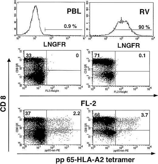 Fig. 3. CTLs specific for CMV pp65 are preserved in RV cells. / T cells specific for the immunodominant HLA-A0201–restricted pp65495-503 peptide derived from the matrix protein pp65 of CMV were detected by staining with a QR-conjugated CD8 and a PE-conjugated pp65 tetramer followed by cytofluorometric analysis. Upper panels show the expression of ΔLNGFR in PBLs (upper left panel) and RV cells (upper right panel). Middle panels show FL-2 autofluorescence of cells stained with QR-conjugated CD8 antibody and FITC-ΔLNGFR antibody. Lower panels show the percentage of QR-CD8+/PE-pp65-tetramer+ T cells in PBLs.