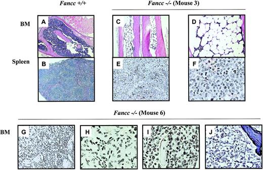Fig. 6. Histologic evidence of BM hypoplasia and myelofibrosis. / (A) H&E staining of the BM from a mouse transplanted withFancc+/+ cells (magnification × 100). (B) H&E staining of the spleen from a mouse transplanted withFancc+/+ cells (magnification × 100). (C) H&E staining of the BM from mouse 3 (magnification × 100). (D) Magnification × 200 revealed a hypoplastic marrow. (E) H&E staining of the spleen from mouse 3 (magnification × 200). (F) Magnification × 400 revealed abnormal splenic architecture with an increased number of immature myeloid cells. (G) H&E staining of the BM from mouse 6 (magnification × 200). (H-I) Magnification × 400 revealed a hypercellular BM with a marked degree of myeloid hyperplasia and significant myelofibrosis. (J) Reticulin staining of the BM from mouse 6 (magnification × 400) to identify collagen deposition, which confirms myelofibrosis.