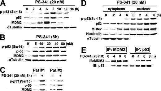 Fig. 1. Induction of phosphorylation and protein expression of p53 and MDM2 by PS-341. / (A) PS-341 induces p53 phosphorylation (Ser15) and increased protein expression of p53 and MDM2 in MM.1S cells in a time-dependent fashion. Anti–α-tubulin antibody is used to confirm equal loading of proteins. (B) PS-341 induces p53 phosphorylation (Ser15) and increased protein expression of p53 and MDM2 in MM.1S cells in a dose-dependent fashion. Anti–α-tubulin antibody is used to confirm equal loading of proteins. (C) PS-341 induces p53 phosphorylation (Ser15) and increased protein expression of p53 and MDM2, in purified patient MM cells. Pat indicates patient. (D) Localization of p-p53, p53, and MDM2 proteins in cytoplasmic and nuclear fractions of MM.1S cells treated with PS-341. Anti–α-tubulin and anti–nucleolin antibodies are used to confirm equal loading of cytoplasmic and nuclear proteins, respectively. (E) Coimmunoprecipitation of p53 and MDM2 in MM.1S cells treated with PS-341.