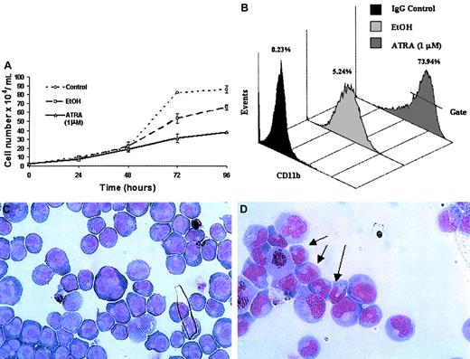 Fig. 2. Differentiation of NB4 cells following exposure to ATRA. / NB4 cells seeded at a density of 2 × 104/mL in RPMI 1640 media containing 10% FBS were left untreated (control) or treated with either all-trans retinoic acid (ATRA) at a concentration of 1 μM or vehicle (EtOH) for the indicated times. Differentiation was indicated as a decrease in the rate of proliferation, compared with controls, as measured by the direct counting method of viable cells (A); each data point represents the mean of 3 independent experiments with standard errors. NB4 differentiation was monitored by (B) a direct immunofluorescence assay using a phycoerythrin-conjugated monoclonal anti-CD11b antibody or isotype control. The percentage values of gated CD11b+ cells identified following 48 hours of ATRA or vehicle treatment were evaluated on the FL2 channel. This assay was carried out on all NB4 cells used in subsequent analyses; a representative output of 3 experiments is shown. Terminal differentiation of NB4 cells treated with EtOH (C) or ATRA (D) for 96 hours was analyzed by microscopic examination (original magnification × 1000) of glass slides following May-Grünwald Giemsa staining. Nuclear segmentation (arrow) and granule formation were observed in the ATRA-treated cells. A representative of 3 independent experiments is shown.