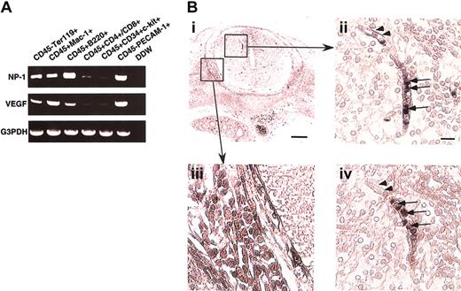 Fig. 1. NP-1 expression on hematopoietic cells. / (A) RT-PCR analysis of NP-1 and VEGF-A expression in various fractions of hematopoietic cells from the fetal liver. High NP-1 expression was detected in CD45+B220+ and CD45+Mac-1+ cells; however, very low NP-1 expression was detected in the fraction of stem cells marked as CD45+CD34+c-kit+ cells. RNA from CD45–PECAM-1+ ECs was used for positive control. (B) Histologic analysis of NP-1 expression on hematopoietic cells in embryo. (i) Transversal section of spinal cord stained with anti–NP-1 antibody. Boxes are viewed in higher power in panels ii and iii. (ii) Round cells in the lumen of a vessel (arrows) and ECs lining the vessel (arrowheads) are positively stained with anti–NP-1 antibody. (iii) Neuronal cells in the DRG are positively stained with anti–NP-1 antibody. (iv) Serial section of panel ii stained with anti-CD45 antibody. Round cells in the vessel as observed in panel ii are positively stained with anti-CD45 antibody. Positively stained cells are visualized as dark blue products. Isotype-matched control Ig for anti-CD45 or anti–NP-1 antibody did not show any staining. Scale bar indicates 50 μm (i,iii); 20 μm (ii,iv).