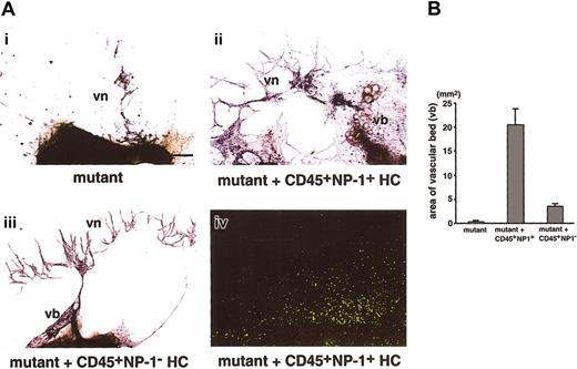 Fig. 3. Effect of hematopoietic cells expressing NP-1 on vascular development in the P-Sp culture. / (A) The development of ECs in P-Sp cultures from E9.5 NP-1−/− embryos. Culture plates were fixed after 14 days of culture and stained with anti–PECAM-1 mAb. PECAM-1+ cells are visualized as dark blue products. (i) In mutant embryo, formation of the vascular bed and network is defective. (ii) The addition of CD45+ cells from the fetal liver of E12.5 GFP embryo (5 × 103 cells per well), which are also positive for NP-1, rescued the defective formation of the vascular bed (vb) and network (vn); however, these cells did not differentiate to endothelial cells as confirmed by their morphology (iv). (iii) The addition of CD45+ cells from the fetal liver of E12.5 NP-1−/− embryo did not rescue the defective vascular formation. (iv) Localization of GFP+ HCs in panel ii. Formation of vb and vn observed in panel ii is comparable to that observed in the culture using P-Sp explants from wild-type embryo. Scale bar indicates 200 μm. (B) Comparison of the area of the vascular bed. The area of the vascular beds in the images in panel A was determined by NIH image 1.62 software. The vascular area per explant is as follows: (i) 0.3 ± 0.1 mm2; (ii) 20.5 ± 3.2 mm2; (iii) 3.5 ± 0.5 mm2. Each result was obtained from 3 independent experiments and is expressed as the mean ± SD.