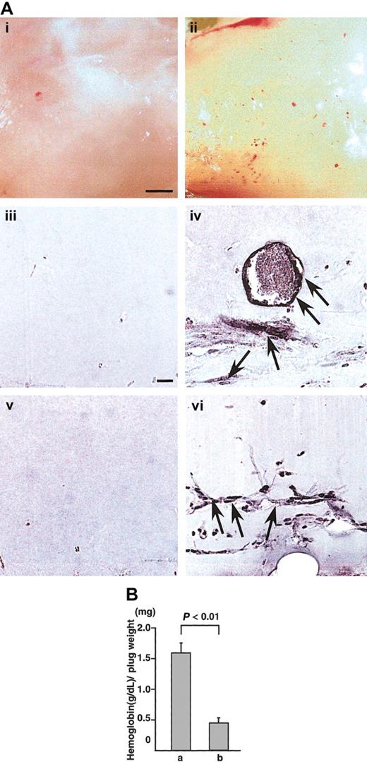 Fig. 4. Hematopoietic cells expressing NP-1 induce angiogenesis in in vivo Matrigel assay. / (A) Matrigels containing CD45+B220+ cells from E12.5 fetal liver of wild type (ii,iv,vi) or CD45+B220+ cells from E12.5 fetal liver of NP-1 mutants (i,iii,v) were injected subcutaneously near the abdominal midline of 8-week-old C57BL mice. (i-ii) Gross appearance of Matrigels on day 5. (iii-vi) Histologic analysis of sections from the Matrigels. ECs were visualized by the staining with anti–PECAM-1 antibody (iii-iv) or anti–VEGFR-2 antibody (v,vi). Scale bar indicates 500 μm (i-ii) and 50 μm (iii-vi). Arrows indicate newly formed vessels in the Matrigel plugs. (B) Values represent the concentration of hemoglobin (g/dL) per Matrigel plug weight (mg) ± SE for 6 assays. “a” is CD45+ NP-1+ cells with VEGF165; “b,” CD45+ NP-1–cells with VEGF165.