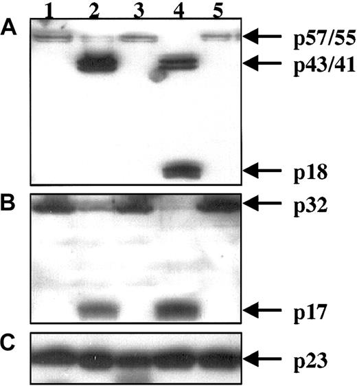 Fig. 2. Cleavage of caspase-8 and caspase-3 in PMNs. / Whole-cell lysates from freshly isolated PMNs (lane 1), from PMNs cultured for 6 hours without additions (lane 2), with 150 μM zVAD-fmk (lane 3), with 20 ng/mL TNF-α (lane 4), or with the TNF-α/zVAD-fmk combination (lane 5) were subjected to SDS-PAGE. Western blot was performed with anti–caspase-8 monoclonal Abs (A). Then the blot was reprobed with anti–caspase-3 polyclonal Abs (B). The expression of Bax protein determined by anti-Bax polyclonal Abs was used as a measurement for equal protein loading (C). Results are representative of 3 independent experiments.