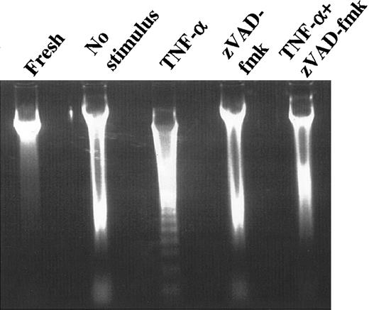Fig. 3. DNA laddering in PMNs. / DNA extracted from freshly isolated PMNs as well as from PMNs cultured for 6 hours without additions, with 20 ng/mL TNF-α, with 150 μM zVAD-fmk or with the combination of these agents, was separated by agarose gel electrophoresis, and internucleosomal fragmentation (DNA laddering) was assessed. Results are representative of 3 separate experiments.