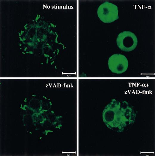 Fig. 4. Staining patterns of mitochondria in PMNs. / PMNs were incubated for 6 hours without additions (No stimulus), with 20 ng/mL TNF-α, with 150 μM zVAD-fmk, or with the TNF-α/zVAD-fmk combination. Then the cells were stained with MitoTracker GreenFM and analyzed with CLSM. Each image represents the following proportion of the total cell population (mean ± SEM): 73.8% ± 8.9% in No stimulus; 66.7% ± 5.4% in TNF-α; 89.0% ± 4.3% in zVAD-fmk; 77.0% ± 3.6% in TNF-α/zVAD-fmk. Bar is 5 μm. Results are representative of at least 4 independent experiments.