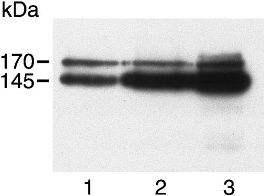 Fig. 1. c-met in HASMCs, HUVECs, and A431 cells. / Cell lysates of HASMCs (lane 1), HUVECs (lane 2), and A431 cells (lane 3) were separated by 7.5% SDS-PAGE, then immunoblotted using a polyclonal antibody to the c-terminus of the c-met β chain. A 170-kDa precursor and 145-kDa mature β chain were visualized in all 3 cells.