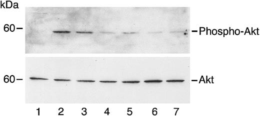 Fig. 3. Angiostatin inhibits HGF-induced phosphorylation of Akt in HUVECs. / HUVECs in serum-free medium were unstimulated (lane 1) or treated with HGF (10 ng/mL) in the absence (lane 2) or presence (lanes 3-7) of angiostatin. Angiostatin concentrations were 0.5 μM (lane 3), 0.75 μM (lane 4), 1.0 μM (lane 5), 2 μM (lane 6), or 3 μM (lane 7). After a 5-minute incubation, cell lysates were prepared and immunoblotting for phospho-AKT was performed as described. The blot was stripped and re-probed for total Akt.