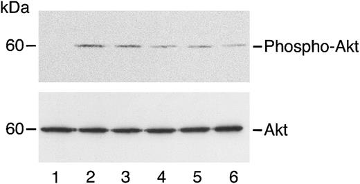 Fig. 4. Angiostatin inhibits HGF-induced phosphorylation of Akt in HASMCs. / HASMCs in serum-free medium were unstimulated (lane 1) or treated with HGF (10 ng/mL) in the absence (lane 2) or presence (lanes 3-6) of angiostatin. Angiostatin concentrations were 0.5 μM (lane 3), 0.75 μM (lane 4), 1.0 μM (lane 5), or 3 μM (lane 6). After a 5-minute incubation, cell lysates were prepared and immunoblotting for phospho-AKT was performed as described. The blot was stripped and re-probed for total Akt.