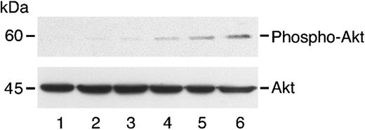 Fig. 5. Reversal of angiostatin inhibition of AKT phosphorylation with excess HGF. / HUVECs in serum-free medium were untreated (lane 1) or treated with angiostatin (3 μM) and increasing concentrations of HGF: 0.5 ng/mL (lane 2), 10 ng/mL (lane 3), 25 ng/mL (lane 4), 50 ng/mL (lane 5), and 100 ng/mL (lane 6). After a 5-minute incubation, cell lysates were prepared and immunoblotting for phospho-AKT was performed as described. The blot was stripped and re-probed for total Akt.