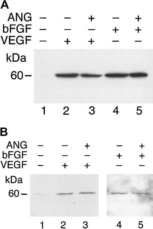 Fig. 6. Angiostatin does not inhibit VEGF- or bFGF-induced phosphorylation of Akt. / HUVECs (A) or HASMCs (B) in serum-free medium were unstimulated (lane 1) or treated with VEGF (50 ng/mL) in the absence (lane 2) or presence (lane 3) of angiostatin (ANG; 5 μM). Similarly, treatment with bFGF, 25 ng/mL (lane 4) resulted in AKT phosphorylation that was not inhibited by angiostatin, 5 μM (lane 5).