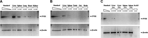 Fig. 6. Biodistribution of HC-Ad vectors, gene transfer efficiency, and FVIII mRNA expression analysis. / FVIIIKO mice were injected with 5 × 109 IU Ad-AAT-hFVIII. Semiquantitative PCR (A-B) or RT-PCR (C) using humanFVIII-specific and β-actin–specific primers (n = 3 mice) at an early time point (5 days after injection, T1) in liver, spleen, lung, heart, and kidney (A) and testis, gut, and brain (B). PCR analysis of liver and spleen at a late time point (1 month after injection, T2) is shown in (B). Mice injected with PBS were used as controls (C). For RT-PCR analysis, controls included samples without reverse transcriptase (no RT) to exclude genomic DNA contamination. Molecular weight (MW) marker was the 100-bp ladder. FVIII PCR generated a 0.6-kb fragment, and β-actin PCR generated a 0.2-kb fragment. Standard corresponds to 2-fold serially diluted DNA with a known number of FVIII copies (ranging from 4 to 0 FVIII gene copies per diploid genomic equivalent).