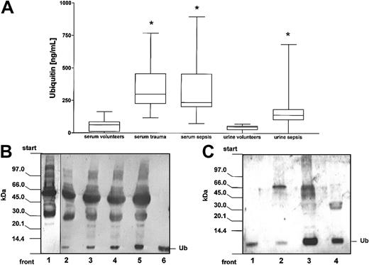 Fig. 3. Detection of ubiquitin in serum and urine. / (A) Ubiquitin serum and urine concentrations in healthy volunteers and critically ill patients. The boxes extend from the 25th to 75th percentile; the horizontal line shows the median. Error bars show the range of data. Data are measurements of ubiquitin concentrations in serum samples from 35 healthy uninjured donors, 23 severely injured blunt trauma patients on the day of admission, and 24 patients with sepsis. Ubiquitin urine concentrations were determined in specimens from 19 sepsis patients and 10 healthy individuals. *P < .05 versus concentrations in specimens from healthy volunteers. (B) Detection of free ubiquitin in serum specimen by immunoblotting. Serum proteins were separated by SDS-PAGE, transferred to PVDF membranes, and probed for ubiquitin with antiubiquitin AS (1:200). Lane 1, healthy donors' serum (15 μg); lanes 2-5, patients' serum (lane 2, 10 μg; lane 3, 15 μg; lane 4, 20 μg; lane 5, 25 μg); lane 6, ubiquitin (Ub; 10 ng). (C) Detection of free ubiquitin in urine specimen (10 μL) by immunoblotting. Lane 1, ubiquitin (Ub; 5 ng); lane 2, healthy donors' specimen; lanes 3 and 4, patients' specimens.