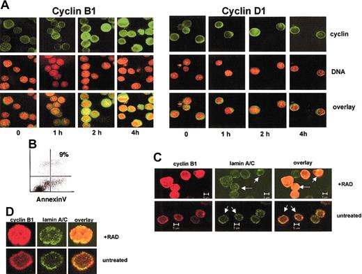Fig. 2. Radiation induces cyclin B1 nuclear accumulation in a time-dependent manner. / (A) Ramos cells subjected to 400 cGy γ radiation and the indicated times after irradiation stained for cyclin B1 or cyclin D1 (green) or DNA (red). The overlay of the images is in yellow. (B) Ramos cells 4 hours after irradiation do not show evidence for apoptosis, as measured by annexin staining. (C) The irradiated Ramos cells have an intact nuclear membrane. Untreated cells or those 4 hours following irradiation were stained with antibodies specific for cyclin B1 (red) or lamins A/C (green). The nuclear lamin is intact in both treatments as evidenced by a circular lamin-staining ring (arrows). An overlay of the 2 colors indicates that cyclin B1 protein is within the nuclear lamina in irradiated Ramos cells. (D) Higher magnification of irradiated and unirradiated Ramos stained for cyclin B1 (red) or lamin A/C (green). Original magnification A,D, × 630.