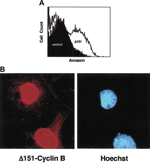 Fig. 4. A cyclin B1 allele lacking CRM1-binding sites induces apoptosis. / (A) Transient transfection of NIH3T3 cells with cyclinB1Δ151 (myc epitope tagged) causes apoptosis, as measured by annexin staining, whereas transfection with the parental pCDNA3-myc vector does not. The figure is representative of 3 experiments. (B) Cells transfected with cyclinB1Δ151 express the protein predominantly in the nucleus as visualized by anti-myc antibody staining. Original magnification × 1000.