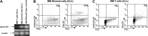 Fig. 3. Plexin-B1 expression in CLL microenvironmental cells obtained from patients' BM. / Primary cultures of stromal cells and isolated T cells were evaluated for the expression of Plexin-B1 both at RNA level by RT-PCR (A) and at protein level by cytofluorograph analysis (B-C) with a polyclonal rabbit antihuman Plexin-B1 Ab (right panels) or with an irrelevant Ab as control (left panels).
