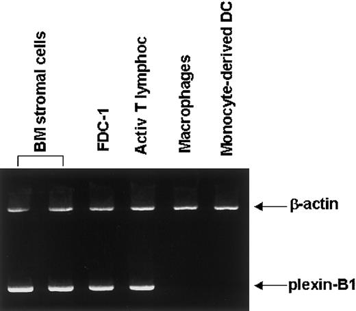 Fig. 4. Plexin-B1 expression in normal microenvironmental cells. / RT-PCR analysis of Plexin-B1 expression in 2 samples of normal primary BM stromal cells, in a follicular dendritic cell line (FDC-1), in normal in vitro–activated T lymphocytes, in macrophages, and in monocyte-derived dendritic cells (DCs). The size of Plexin-B1–amplified products was 303 base pairs as expected.