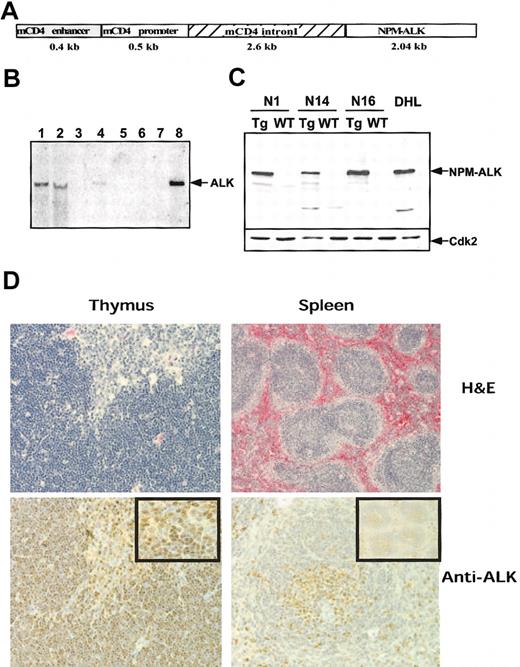 Fig. 1. Generation of NPM-ALK Tg mice. / (A) NPM-ALK cDNA was cloned into a construct containing the CD4 enhancer and promoter as described in “Materials and methods.” (B) Southern blotting of representative animals obtained from different foster mothers. BamHI-digested DNAs were hybridized with a radio-labeled ALK cDNA probe (1 = N1, 2 = N16, 4 = N15, and 8 = N8. Lane 3, 5, 6, and 7 correspond to correspondent normal littermate). (C) The expression and size of the fusion protein was characterized by Western blot. Proteins were extracted from thymi of Tg (N1, N14, and N16) and wild-type (WT) mice and loaded onto SDS-PAGE gel. The expression of the NPM-ALK chimera was detected with polyclonal rabbit anti-ALK antibody. The protein extract from the human ALCL-derived cell line DHL was used as a control. The loading was checked by Western blot for the ubiquitous CDK2 protein. (D) Histology of NPM-ALK Tg mice. Tg thymus (left panels) or spleen (right panels) were fixed in formalin and embedded in paraffin. Hematoxylin and eosin stains (top panels, × 100) showed normal thymus and spleen architecture in the preneoplastic tissue. Immunostaining with anti-ALK antibody (bottom panels) demonstrated a diffuse positivity in Tg thymocytes with stronger signal in medullary lymphocytes (× 100). In Tg spleen the ALK positivity was localized in the periarteriolar T cell areas of the white pulp (× 400). Left insert shows a nuclear and cytoplasmic staining in Tg lymphocytes (× 400); right insert shows a lower magnification of the spleen (× 100).