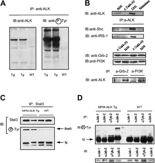 Fig. 2. Molecular characterization of NPM-ALK Tg mice. / (A) Expression and constitutive activation of NPM-AK in Tg mice. Thymocytes from Tg and WT mice were lysed and immunoprecipitated with anti-ALK Ab as described in “Materials and methods.” Western blot with anti-ALK revealed the presence of the protein in Tg but not WT mice (left panel). NPM-ALK protein was constitutively phosphorylated in Tg mice as revealed by the antiphosphotyrosine Ab (right panel). (B) NPM-ALK protein expressed in murine T cells coprecipitates with Shc, IRS-1, Grb-2, and PI3K. Lysed from ALK+samples were immunoprecipitated with anti-ALK (upper panel) or with anti–Grb-2 or anti-PI3K (lower panel). Immunocomplexes were gel electrophoresed and, after transfer, incubated with the indicated antibodies. Direct Western blotting were also performed as indicated. All data are representative of at least 3 different experiments. (C) NPM-ALK Tg mice activate Stat3. Proteins extracted from Tg and WT thymocytes were immunoprecipitated with anti-Stat3 Ab and loaded onto a SDS-PAGE gel. Stat3 protein was similarly immunoprecipitated from both Tg and WT thymocytes. Antiphosphotyrosine Ab revealed the presence of higher levels of activated Stat3 in NPM-ALK Tg mice. (D) NPM-ALK Tg mice activate Jak3. Jak-family of proteins were immunoprecipitated from Tg and WT mice and detected with antiphosphotyrosine Ab. Only Jak3 was constitutively phosphorylated in Tg but not in WT mice. The Jak-family of proteins were equally immunoprecipitated in Tg and WT mice.