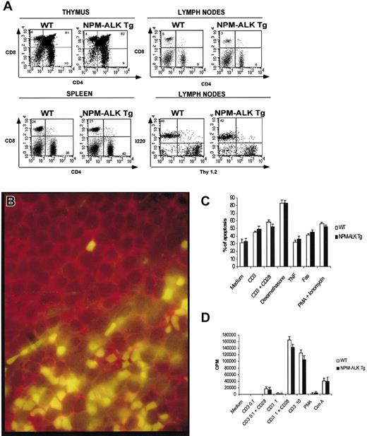 Fig. 3. Normal phenotype of NPM-ALK Tg mice. / (A) Single cell suspensions obtained from thymocytes, spleen, and lymph nodes were stained with the indicated antibodies and analyzed as described in “Materials and methods.” Tg and WT mice had comparable phenotype in both immature and mature T cells and B lymphocytes. (B) NPM-ALK expression in mature T and B lymphocytes: NPM-ALK expression is restricted only to T cells. Paraffin-embedded tissue section from a preoplastic of NPM-ALK Tg spleen mouse was stained with anti-ALK (green) and anti-B220 (red) Abs. Normal response of Tg lymphocytes to apoptotic and proliferative stimuli. (C) Tg and WT thymocytes were isolated and stimulated for 24 hours with the indicated reagents. The spontaneous and induced apoptotic rate was comparable in Tg and WT mice. (D) Peripheral T lymphocytes were purified from lymph nodes as described in “Materials and methods” and cultured for 72 hours in the presence of the indicated reagents. 3H-thymidine was added for the last 18 hours of culture. Proliferative responses of WT and Tg mice were comparable. The data are representative of at least 2 independent experiments.
