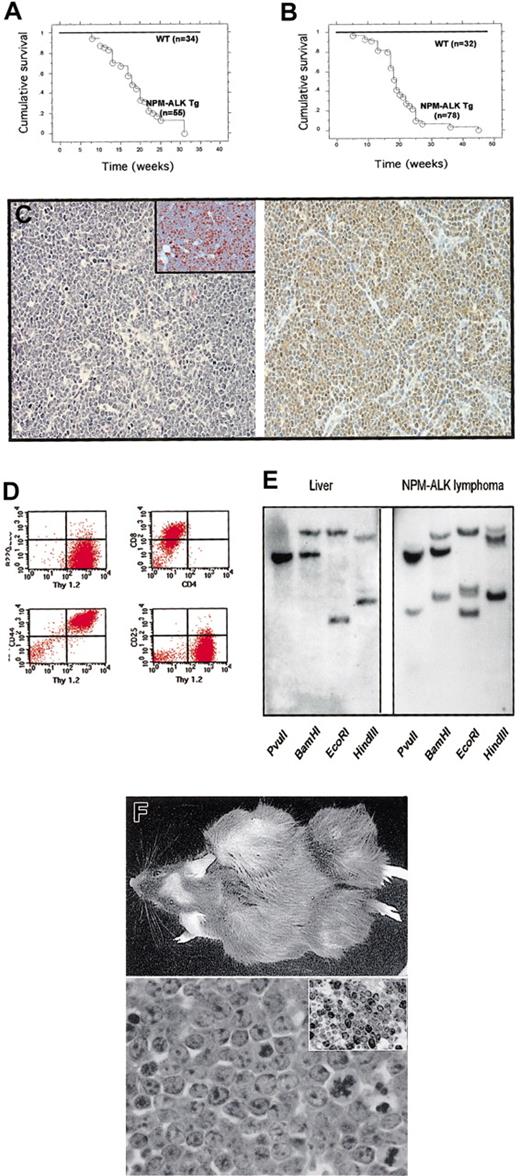 Fig. 4. NPM-ALK Tg mice develop lymphomas. / Survival curves NPM-ALK Tg lines N16 (A) and N1(B). (C) Thymic lymphomas. Thymic lymphomas were composed of a homogeneous population of medium-sized lymphoid cells. Numerous mitosis and apoptotic bodies were present (left panel, × 100) (Ki67+ cells were documented by immunohistochemistry, insert; × 200). Immunohistochemical staining with anti-ALK Ab demonstrated a nuclear and cytoplasmic expression of the NPM-ALK fusion protein (right panel, × 100). (D) Typical phenotype of thymic lymphomas. Tumor cells obtained from neoplastic thymus were stained with the indicated Abs and analyzed (Thy1+, B220−, CD44+, CD8+, CD4+/−, CD25−). (E) Southern blot analysis of NPM-ALK lymphomas showing a rearranged pattern of the T-cell receptor with all the enzymes used for digestion. Germline liver DNA was used as control. (F) NPM-ALK T-cell lines established tumors in immunodeficient mice. Tumor cells (2 × 106) (NPM-ALK-Ova) were injected subcutis, and animals were followed daily for 4 weeks (upper panel). Tumors were composed of medium-sized blasts (lower panel, × 400) with high proliferation index (anti-Ki67 staining in the insert, × 200).