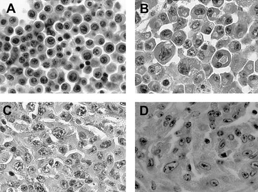 Fig. 5. NPM-ALK Tg mice develop plasma cell tumors. / (A-D) Histologic sections of 4 representative plasma cell neoplasms (×400).