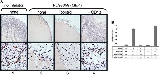 Fig. 7. CD13/APN rescues angiogenesis in vivo. / Matrigel containing bFGF, heparin, and either the vehicle control (column 1) or the MEK inhibitor PD98059 (columns 2-4) plus functional CD13/APN-high (column 4) or control EOMA (column 3) membrane preparations were injected subcutaneously into mice. Plugs were harvested after 7 days and (A) examined for CD31+ (brown color, anti-CD31) endothelial-lined tubules and infiltration of inflammatory cells (top panel, original magnification × 10; bottom panel, original magnification × 40); or (B) angiogenesis quantitated by hemoglobin content.