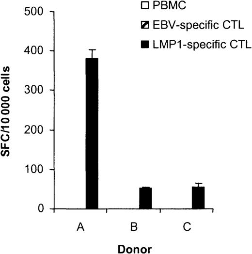 Fig. 4. LMP1-specific CTL lines recognize the HLA-A2–restricted LMP1 epitope YLQQNWWTL (YLQ). / The ability of T cells in PBMCs, EBV-specific CTLs, and LMP1-specific CTLs to secrete IFN-γ in response to the LMP1 peptide YLQ was determined in ELISPOT assays. Spot-forming cells (SFCs) were quantified by Zellnet Consulting. No reactive cells were observed in PBMCs and EBV-specific CTLs for all 3 donors. The frequency of YLQ peptide–reactive LMP1-specific CTLs was 3.82% for donor A, 0.52% for donor B, and 0.55% for donor C. YLQ peptide–reactive CTLs were undetectable in PBMCs and EBV-specific CTLs.