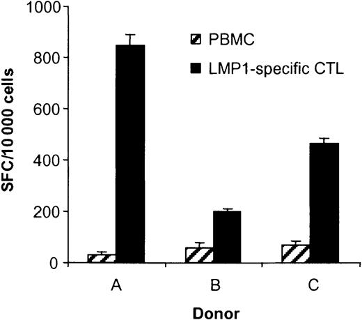 Fig. 5. LMP1-specific CTL lines recognize autologous LCLs. / The ability of T cells in PBMCs, EBV-specific CTLs, and LMP1-specific CTLs to secrete IFN-γ in response to autologous LCLs was determined in ELISPOT assays. Spot-forming cells (SFCs) were quantified by Zellnet Consulting. The frequency of LCL-reactive CTLs in LMP1-specific CTLs was 8.5% for donor A, 2.0% for donor B, and 4.6% for donor C and, in PBMCs, 0.34%, 0.57%, and 0.68%, respectively.