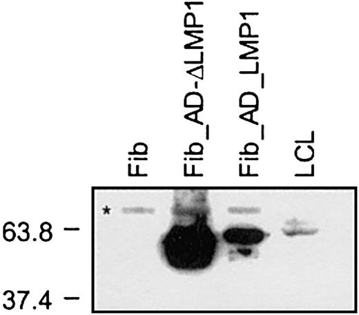 Fig. 7. LMP1 expression in fibroblasts and LCLs. / Fibroblasts were harvested 24 hours after transduction with Ad_LMP1 and Ad_ΔLMP1; 2 × 103 cells per lane of fibroblasts and 2 × 105 cells per lane of LCLs were loaded. LMP1 expression was detected by Western blot using the monoclonal antibody cocktail CS1-4 and HRP-conjugated secondary antibodies. LMP1 expression was detected in transduced fibroblasts as well as LCLs, and the level of LMP1 expression was higher in fibroblasts than in LCLs. Protein standards are indicated at the left in kilodaltons (*cross-reactive band only present in fibroblasts).