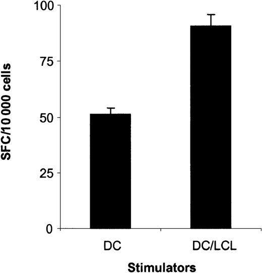 Fig. 8. LMP1-specific CTLs generated by initial DC_ΔLMP1 stimulations followed by autologous LCL stimulations recognize the HLA-A2–restricted LMP1 epitope YLQQNWWTL (YLQ). / The ability of LMP1-specific CTLs generated by DC_ΔLMP1 stimulations followed by autologous LCL stimulations to secrete IFN-γ in response to the LMP1 peptide YLQ was determined in ELISPOT assays. Spot-forming cells (SFCs) were quantified by Zellnet Consulting. The frequency of YLQ-reactive CTLs was 0.9% in contrast to 0.52% for LMP1-specific CTLs, which were only stimulated with DC_ΔLMP1 (P < .001; Wilcoxon signed rank test)