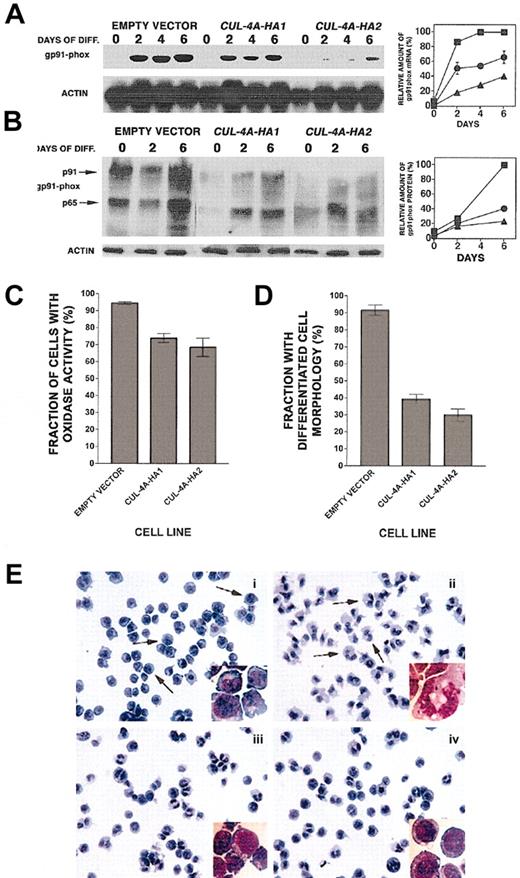 Fig. 3. Enforced expression of. / CUL-4A inhibits granulocytic differentiation. (A) The cell lines generated from PLB-985 cells transfected with pEF-PGKpac (empty vector) or with pEFpac-CUL-4A-HA (CUL-4A-HA1 or CUL-4A-HA2) were induced with DMF to differentiate into granulocytes for 0 to 6 days, and total RNA was isolated from a sample taken at each time point. RNA (5 μg) from each sample was electrophoresed, and the amount of gp91phox mRNA was determined by Northern blot analysis and normalized with respect to the amount of actin mRNA. The average of results from 2 independent experiments appears in the graph to the right of the autoradiogram (empty vector control, ▪;CUL-4A-HA1, ●; CUL-4A-HA2, ▴). 100% corresponds to the amount of gp91phox mRNA measured in control cells 6 days after induction. Error bars denote SEM. For data points with no visible error bars, the error bars are smaller than the symbol. (B) The 3 cell lines were induced with DMF as described for panel A, and total protein was isolated from a sample taken at each time point. Protein (10 μg) from each sample was electrophoresed, and the amount of gp91phoxprotein was determined by immunoblot and normalized with respect to the amount of actin. The results from a representative experiment are shown. The symbols are as described for panel A. 100% corresponds to the amount of gp91phox protein measured in control cells 6 days after induction. (C) The 3 cell lines were induced with DMF for 4 days, and cells with oxidase activity were detected by their ability to reduce nitro blue tetrazolium to generate violet formazan granules. Cells with oxidase activity were counted and the results from 3 independent experiments were graphed. Error bars represent SEM, which is reported in the text. Comparing eitherCUL-4A-HA1 or CUL-4A-HA2 and the control,P < .01 by Student t test. (D) The 3 cell lines were induced with DMF as described above and slide preparations were stained with Diff-Quick Stain. Cells with band or polymorphonuclear nuclear morphology were counted, and the results of 3 independent experiments were graphed. Error bars represent SEM, which is reported in the text. Comparing either CUL-4A-HA1 or CUL-4A-HA2 and the control, P = .0002 by Student t test. (E) Fields representative of 3 separate experiments graphed in panel D were photographed (magnification × 40 and × 100 for inset images) and appear as follows: (i) empty vector control cells before DMF addition, (ii) empty vector control cells 4 days after induction, (iii) CUL-4A-HA1 cells 4 days after induction, and (iv) CUL-4A-HA2 cells 4 days after induction. Arrows in panel i point to examples of cells with undifferentiated cell morphology, while those in panel ii show differentiated cells.