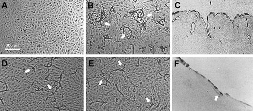 Fig. 1. Plasmin(ogen) dependency of capillarylike tubular structure formation in a fibrin matrix by hMVECs. / hMVECs were cultured on top of a 3-dimensional fibrin matrix in M199 with 10% human serum and 10% newborn calf serum (NBCS) and were not stimulated (A) or stimulated with the addition of 10 ng/mL bFGF and 10 ng/mL TNF-α (B). After 4 days of culture, nonphase photomicrographs were taken. Histologic analysis of cross-sections of structures in the underlying fibrin matrix (C,F). Arrows indicate endothelial cells present in the underlying fibrin matrix. Addition of aprotinin (100 U/mL) (D) or depletion of plasminogen from the matrix and the culture media alter the formation of structures (E-F). Scale bar represents 300 μm.